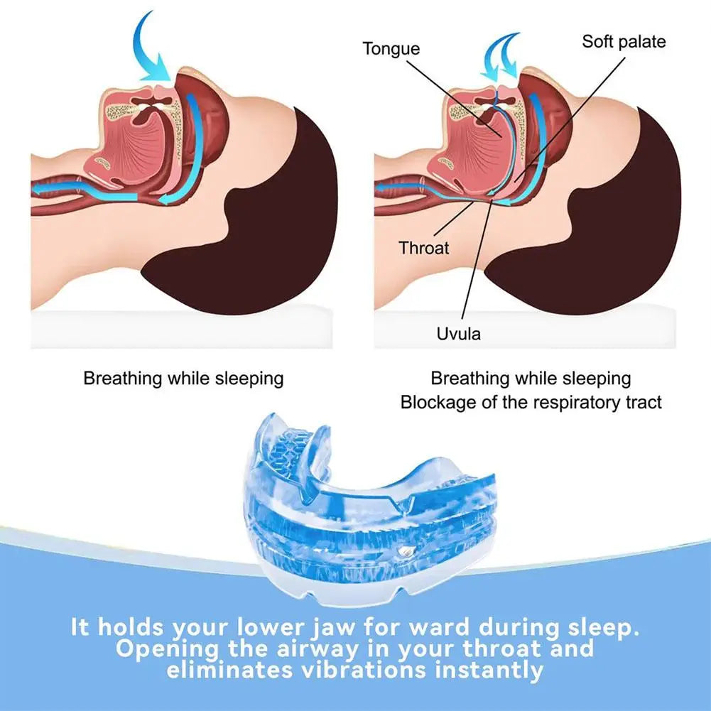 The Quiet Anti-Snoring Mouthpiece (Universal Size)